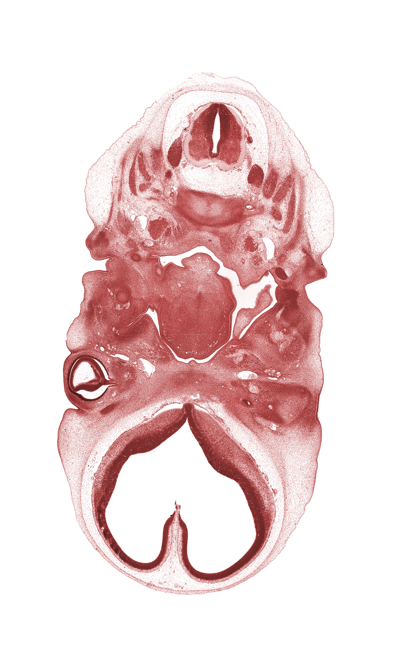 C-1 / C-2 intervertebral disc, C-2 spinal ganglion, C-2 spinal nerve, accessory nerve (CN XI), archipallium, basisphenoid condensation, blastema of extra-ocular muscle(s), blastemata of mastication muscles, cerebral vesicle (telencephalon), external acoustic meatus, facial nerve (CN VII), foramen cecum of tongue, inferior ganglion of vagus nerve (CN X), intraretinal space (optic vesicle cavity), junction of neural retina and optic stalk (CN II), neopallium, notochord, occipital lamina, optic cup cavity, optic stalk (CN II), paleopallium, precardinal vein, root of tongue, spinal accessory nerve (CN XI), vertebral artery