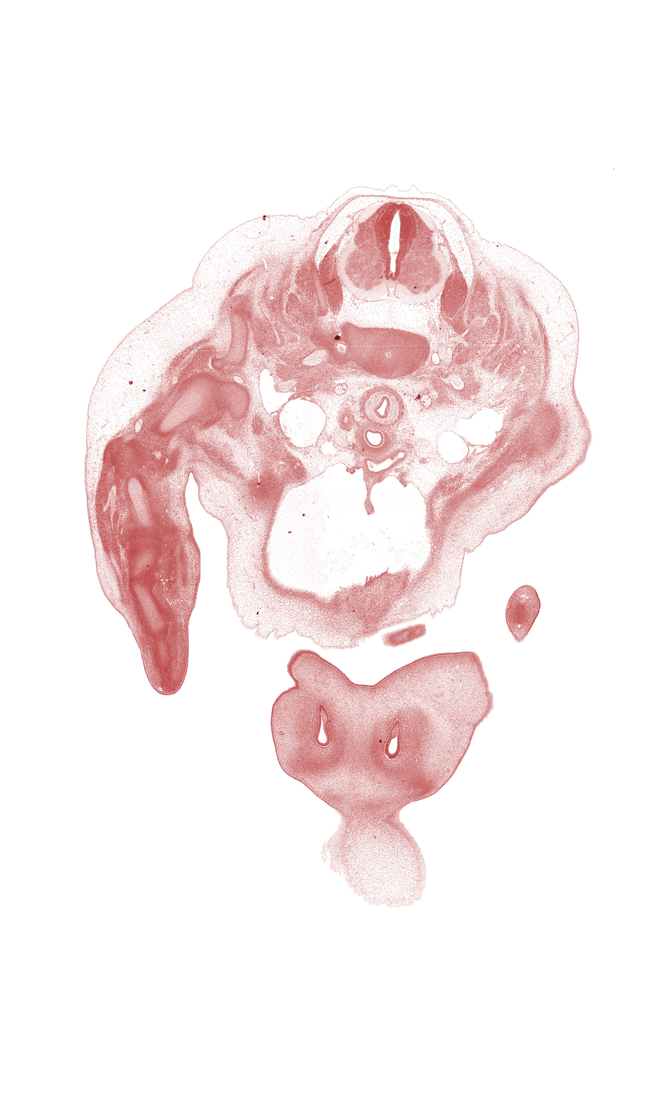 C-5 / C-6 intervertebral disc, C-5 ventral primary ramus, C-6 spinal ganglion, C-6 spinal nerve, arch of aorta, edge of chin, edge of frontal prominence, edge of shoulder, humerus, interorbital ligament, jugular lymph sac, levator scapulae muscle, nasal cavity (nasal sac), nose, pericardial cavity, precardinal vein, scapula, subarachnoid space, trachea, upper limb