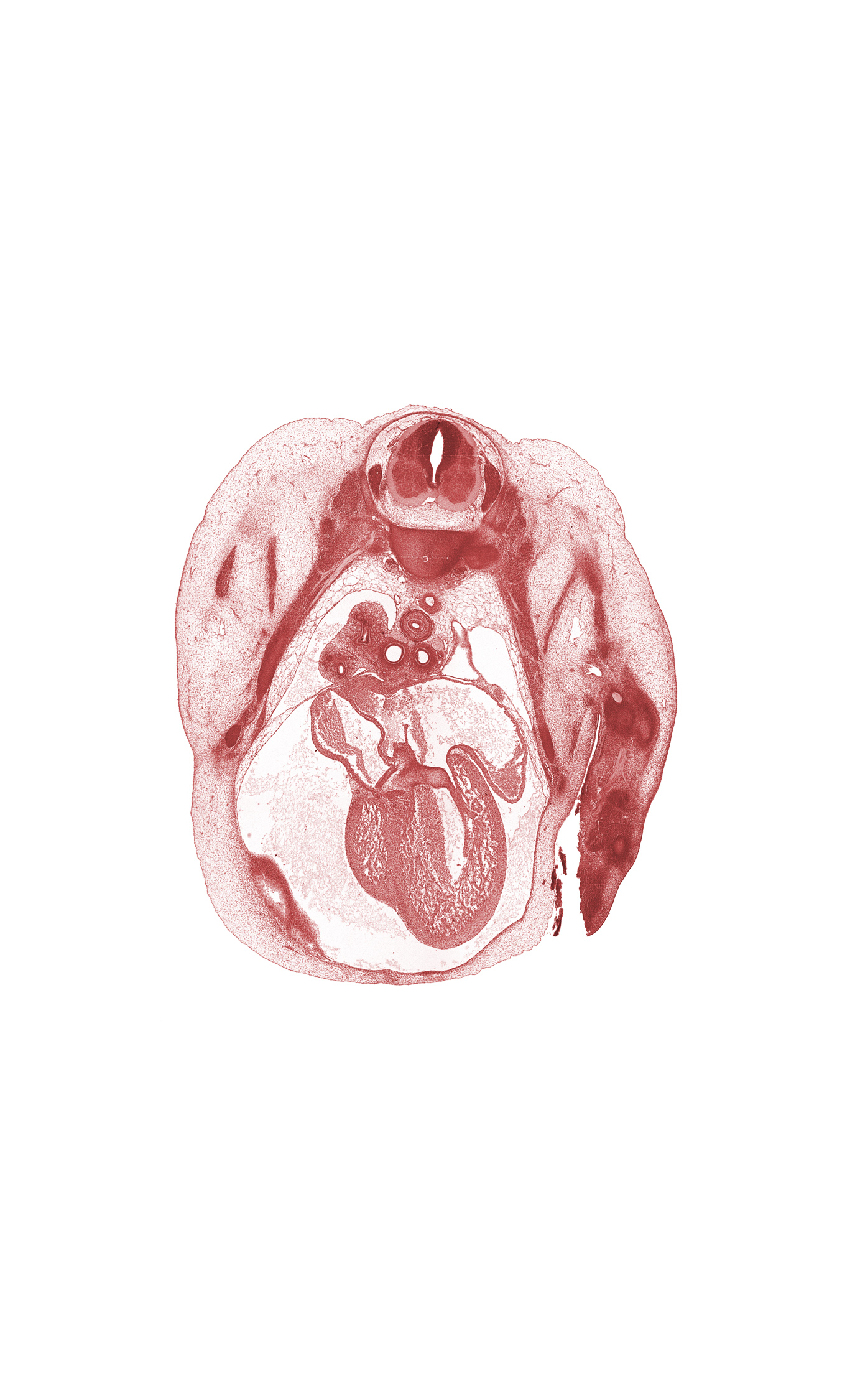 T-3 spinal ganglion, alar plate(s), artifact separation(s), atrioventricular endocardial cushion(s), basal plate, bronchopulmonary bud(s), edge of peritoneal cavity, floor plate, head of rib 4, latissimus dorsi muscle, left atrioventricular canal, left common cardinal vein, left postcardinal vein, left precardinal vein, left ventricle, pericardial cavity, pleural cavity, primary interatrial septum (septum primum) remnant, right atrium, right primary bronchus, right ventricle, roof plate, secondary interatrial foramen (foramen secundum), sulcus limitans, upper lobe of right lung