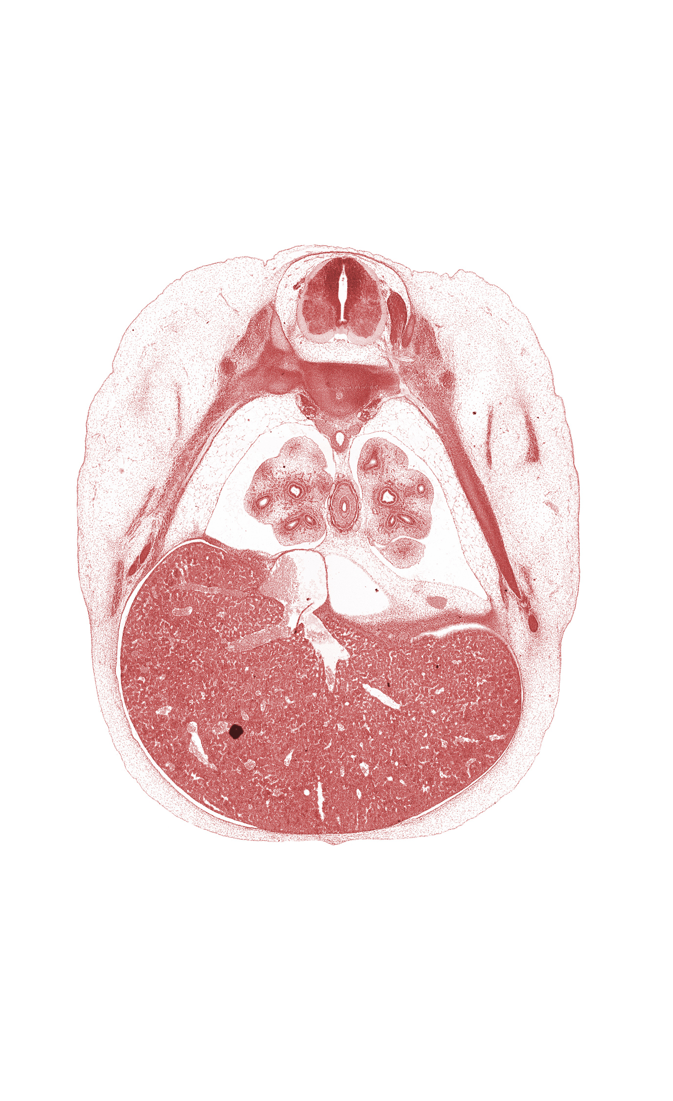 T-6 intercostal nerve, T-6 spinal ganglion, aorta, central canal, inferior vena cava, junction of efferent hepatic veins and inferior vena cava, lateral basal tertiary bronchus of right lung, left efferent hepatic vein, lingula of upper lobe of left lung, liver prominence, lower lobe of left lung, medial basal tertiary bronchus of right lung, oblique fissure, pulmogenic coat, rib 7, rib 8, right efferent hepatic vein, sympathetic trunk