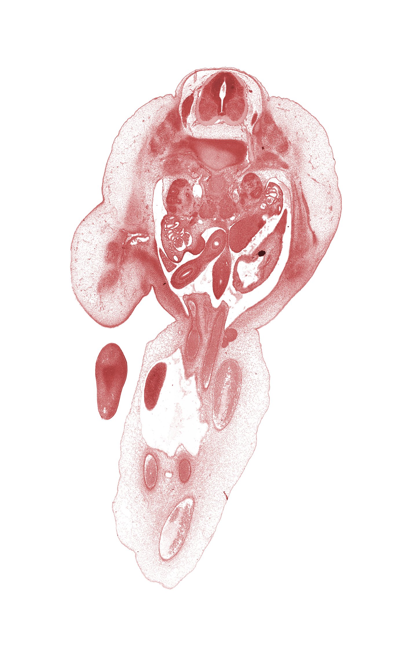 L-1 / L-2 intervertebral disc, L-1 spinal nerve, T-12 / L-1 interganglion region, allantois, amnion, aorta, caudal edge of herniated midgut, caudal edge of lesser sac (omental bursa), caudal edge of right lobe of liver, cephalic edge of L-1 spinal ganglion, dorsal mesogastrium, femoral artery, femoral vein, hindgut, inferior mesenteric artery, junction of allantois and apex of urinary bladder, kidney (metanephros), left umbilical artery, mesonephric duct, mesonephros, ovary, right umbilical artery, umbilical coelom, umbilical cord, umbilical vein