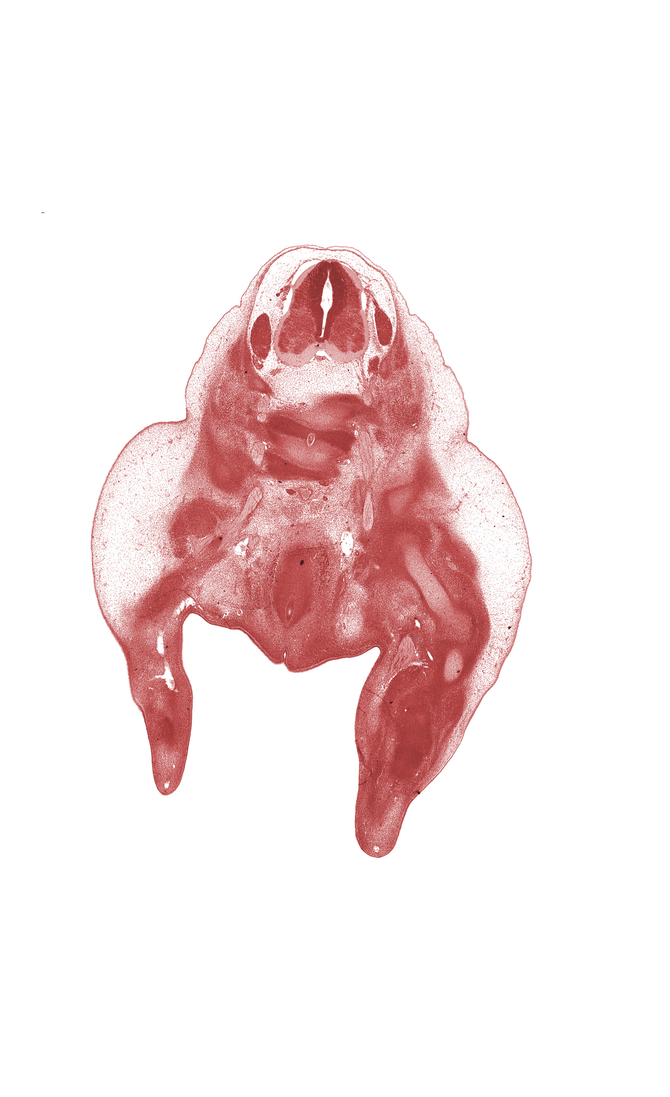 L-3 / L-4 interganglion region, L-3 spinal ganglion, L-4 spinal nerve, L-5 / S-1 intervertebral disc, L-5 ventral primary ramus, S-1 / S-2 intervertebral region, central vein of leg, cephalic edge of L-4 spinal ganglion, dorsal fasciculus, femur, knee joint, labial swelling, lumbosacral trunk, marginal vein, median sacral artery, neural process, rectum, sacral plexus, tibia, urethral fold, urethral groove