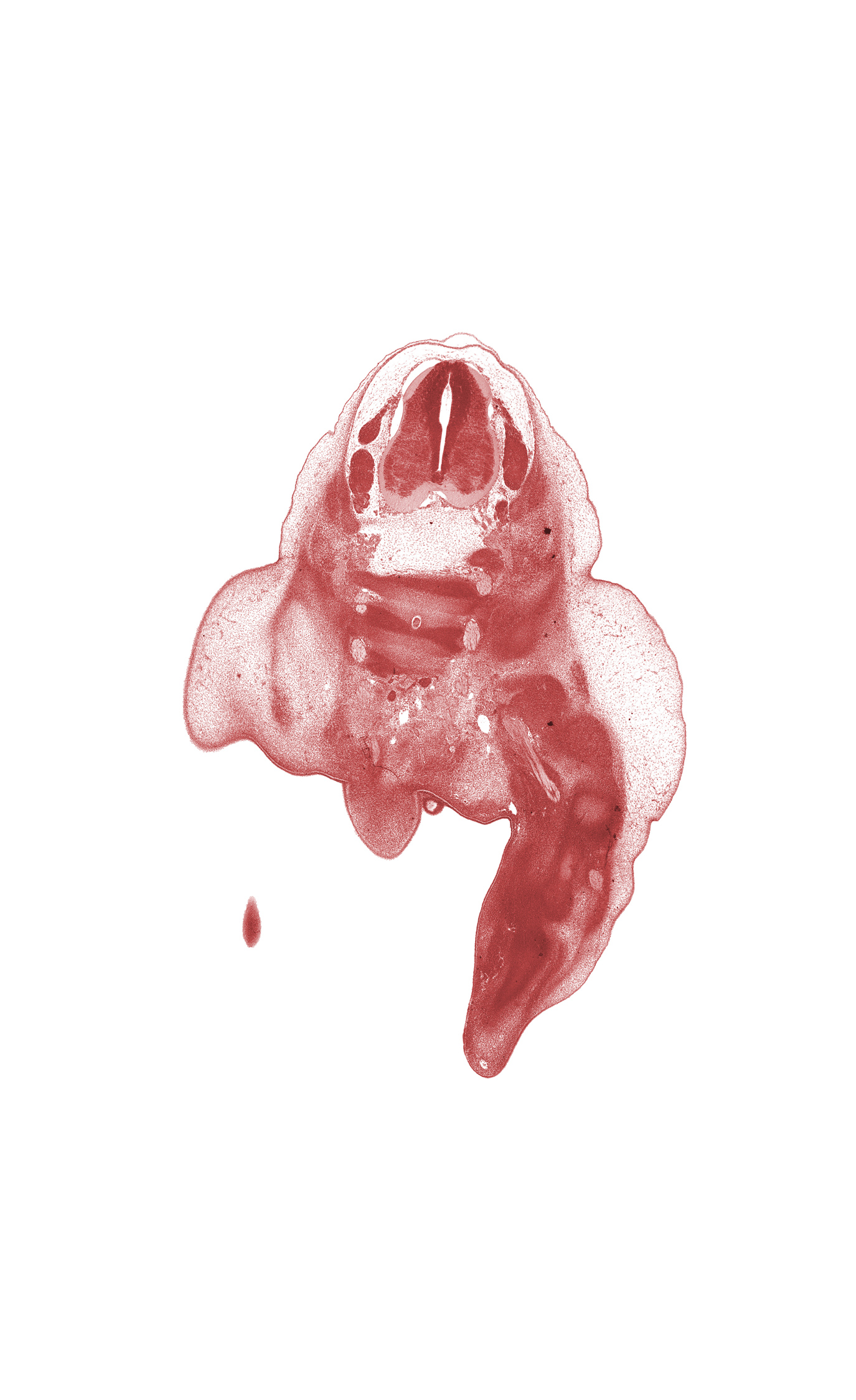 L-4 spinal ganglion, L-5 spinal nerve, S-1 / S-2 intervertebral region, S-1 ventral primary ramus, S-2 ventral primary ramus, S-3 / S-4 intervertebral region, S-3 ventral primary ramus, ala of sacrum, buttox region, caudal edge of lower limb, caudal eminence, cephalic edge of L-5 spinal ganglion, sciatic nerve, subarachnoid space