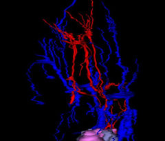 Blood Vessels of the Head