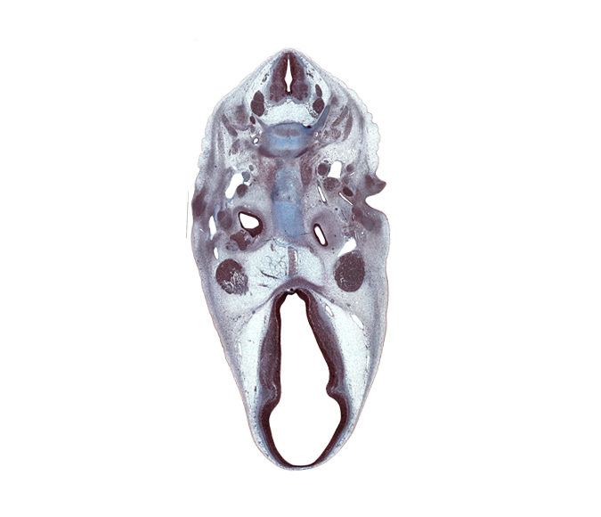 C-2 / C-3 intervertebral disc, C-3 spinal ganglion, C-3 spinal nerve, C-4 spinal ganglion, abducens nerve (CN VI), basi-occipital (basal plate), basilar artery, caudal edge of cochlear duct, centrum of C-2 vertebra (axis), centrum of C-3 vertebra, dorsal thalamus, edge of neurohypophysis, hypothalamus, inferior ganglion of glossopharyngeal nerve (CN IX), internal carotid artery, motor root of trigeminal nerve (CN V), neural arch of C-3 vertebra, notochord, posterior communicating artery, semispinalis capitis muscle, semispinalis cervicis muscle, stapedial artery, stapes condensation, subarachnoid space, ventral thalamus, vertebral artery, zona limitans intrathalamica