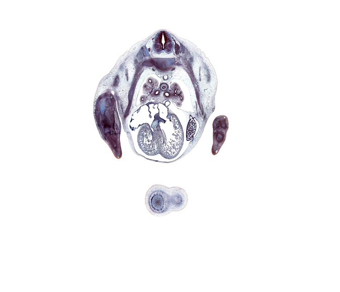 T-4 spinal ganglion, anterior tertiary bronchus, apical posterior tertiary bronchus, cephalic edge of lower lobe of left lung, cephalic edge of mammary gland, extensor compartment of arm, heart prominence, horizontal fissure, iliocostalis muscle, left lobe of liver, longissimus muscle, middle lobe of right lung, neural arch, osteogenic layer, pectoralis major muscle, pericardial cavity, pleural cavity, pleuropericardial membrane, right atrioventricular (tricuspid) valve, right atrium, right primary bronchus, right venous valve, secondary interatrial foramen (foramen secundum), semispinalis muscle, subarachnoid space, superior hemi-azygos vein, upper lobe of left lung, upper lobe of right lung