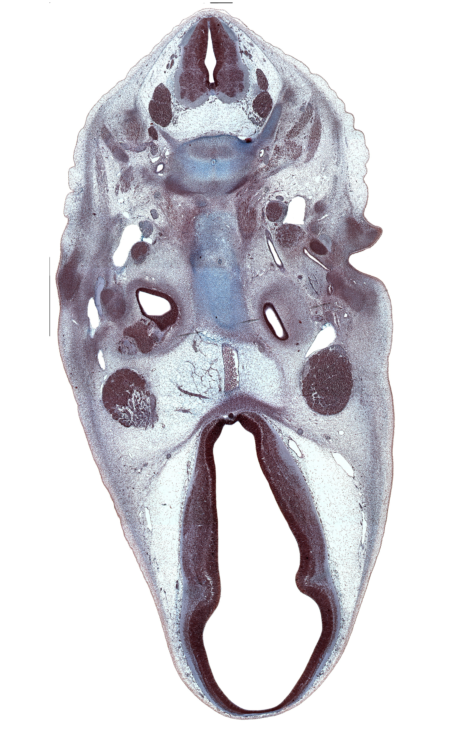 C-2 / C-3 intervertebral disc, C-3 spinal ganglion, C-3 spinal nerve, C-4 spinal ganglion, abducens nerve (CN VI), basi-occipital (basal plate), basilar artery, caudal edge of cochlear duct, centrum of C-2 vertebra (axis), centrum of C-3 vertebra, dorsal thalamus, edge of neurohypophysis, hypothalamus, inferior ganglion of glossopharyngeal nerve (CN IX), internal carotid artery, motor root of trigeminal nerve (CN V), neural arch of C-3 vertebra, notochord, posterior communicating artery, semispinalis capitis muscle, semispinalis cervicis muscle, stapedial artery, stapes condensation, subarachnoid space, ventral thalamus, vertebral artery, zona limitans intrathalamica