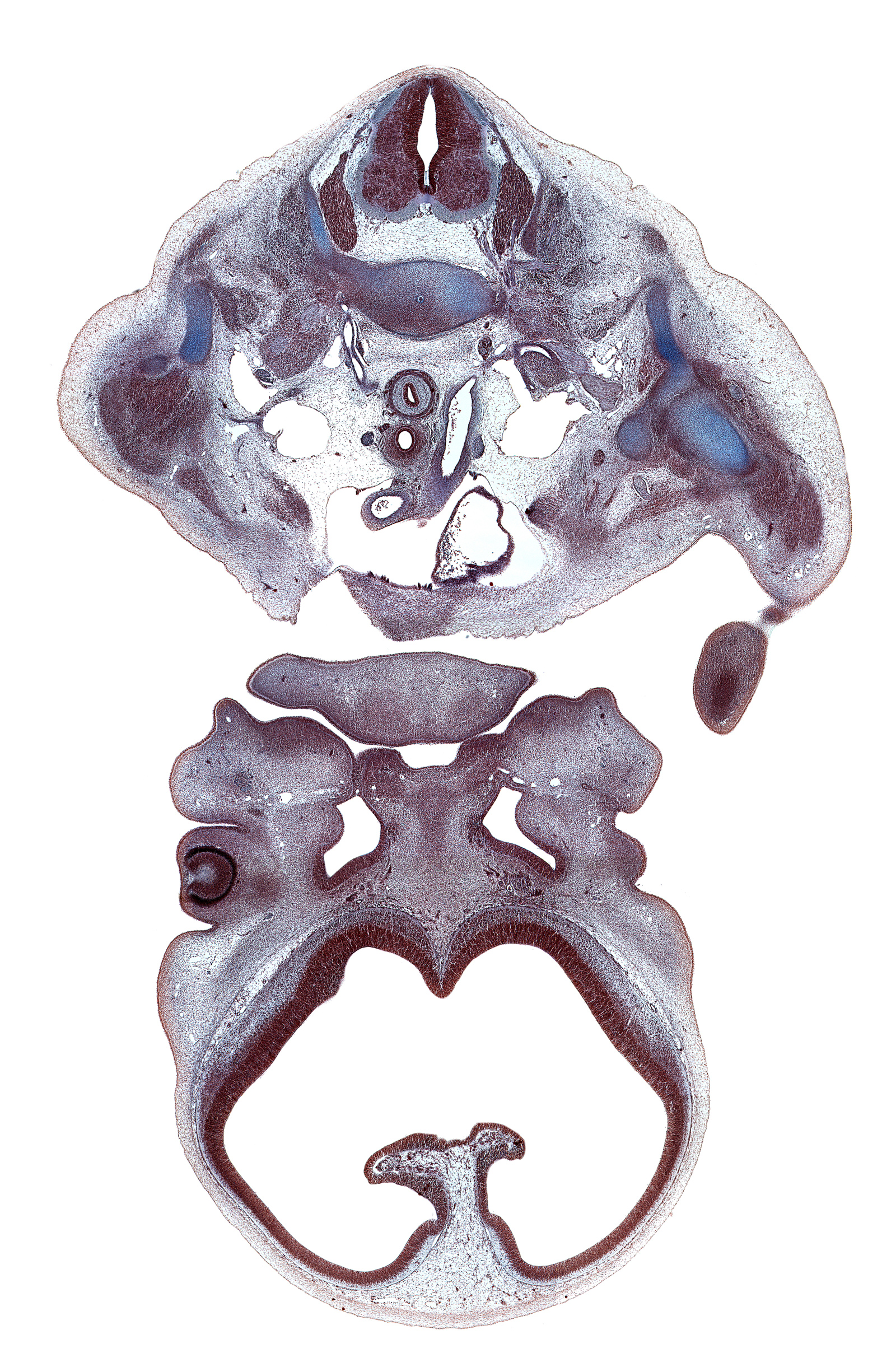 C-6 / C-7 intervertebral disc, C-7 spinal ganglion, artifact(s), ascending aorta, cerebral vesicle (telencephalon), chin, ductus arteriosus, edge of ventricular eminence(s), esophagus endoderm, falx cerebri region, hand plate, hippocampus, inferior nasal concha, interventricular foramen, lateral ventricle, left atrium, left vagus nerve (CN X), maxillary prominence of pharyngeal arch 1, medial nasal prominence(s), middle trunk of brachial plexus (C-7), nasal cavity (nasal sac), olfactory filia (CN I), subarachnoid space, sympathetic trunk, trachea, vertebral artery