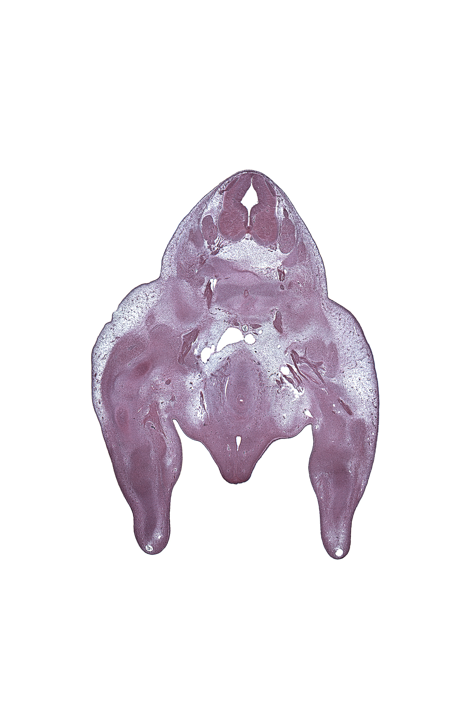 L-5 spinal ganglion, L-5 ventral primary ramus, S-1 / S-2 intervertebral region, S-1 ventral primary ramus, S-2 ventral primary ramus, alar plate(s), basal plate, blastemata of extensor muscles in thigh, caudal edge of peritoneal cavity, central canal, dorsal root(s), femur, labioscrotal swelling, marginal vein, median sacral artery, metatarsal condensation, pelvic plexus, pudendal nerve, rectum endoderm, sulcus limitans, urethra, urethral fold, urethral plate