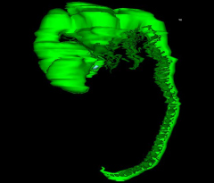 Nervous System