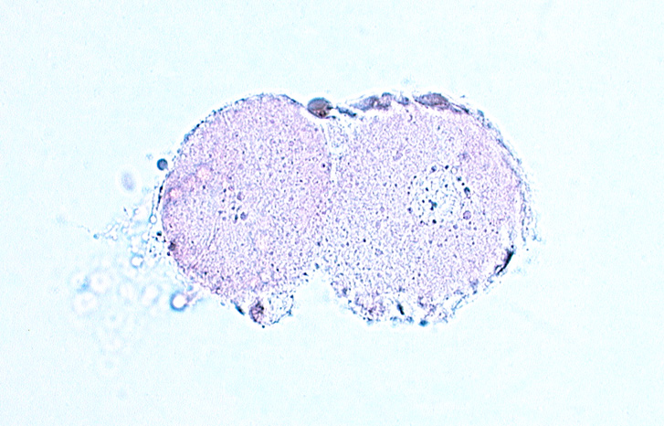 blastomere cytoplasm, cytoplasmic and nuclear material between blastomeres and zona pellucida, edge of blastomere nucleus, polar body, zona pellucida