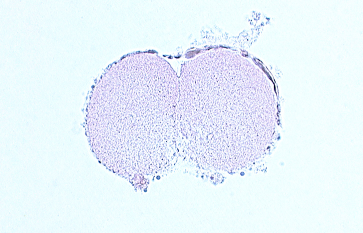 blastomere cytoplasm, contiguous cell membranes along cleavage plane, disrupted zona pellucida, subzonal space