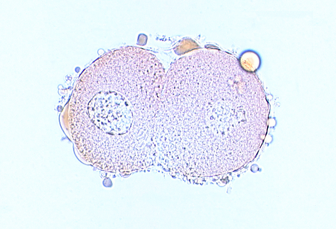 blastomere cytoplasm, blastomere nucleus, contiguous cell membranes, edge of nucleus, zona pellucida