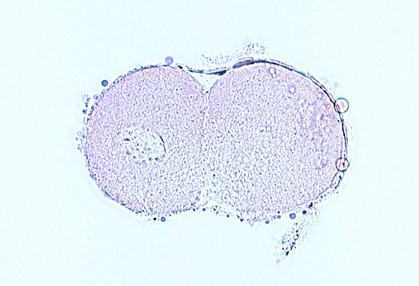 blastomere cytoplasm, edge of blastomere nucleus, subzonal space, zona pellucida