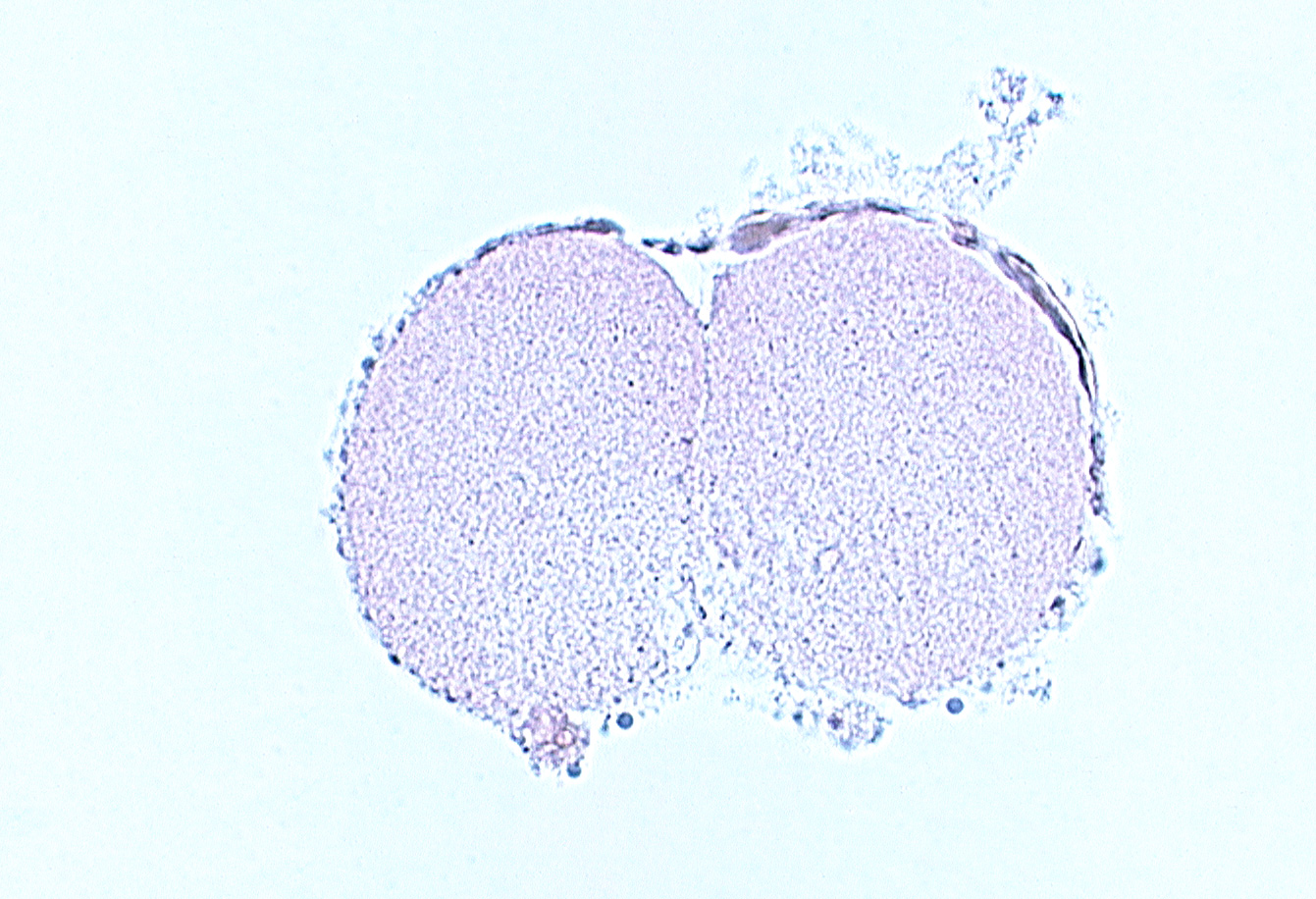 blastomere cytoplasm, contiguous cell membranes along cleavage plane, disrupted zona pellucida, subzonal space