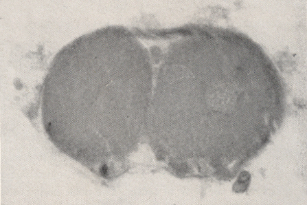 Serial section showing masses of nuclear and granular material