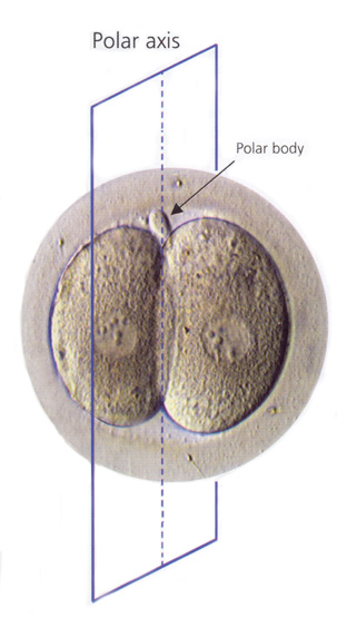 Polar axis