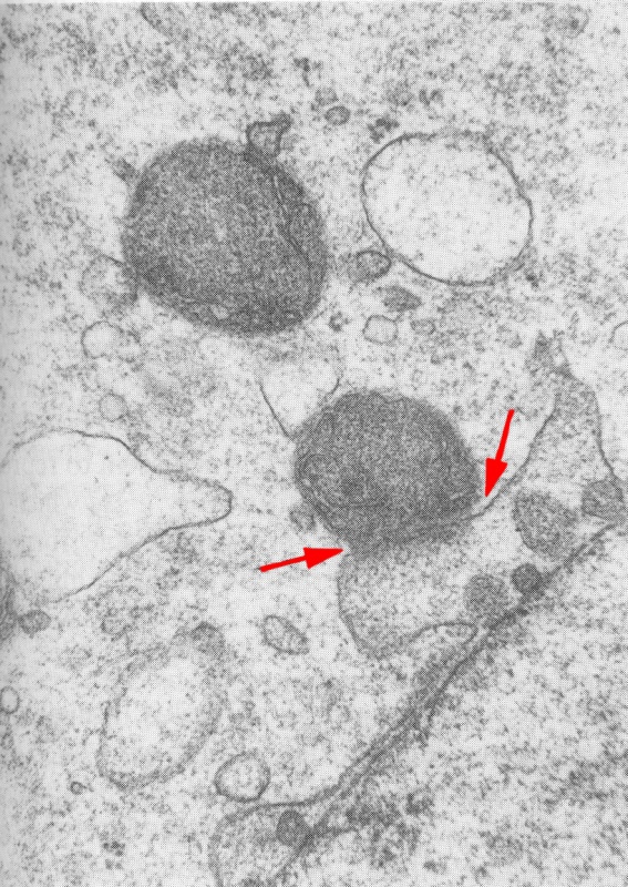 Blebs protruding from the nuclear membrane associated with mitochondria in a 4-cell embryo