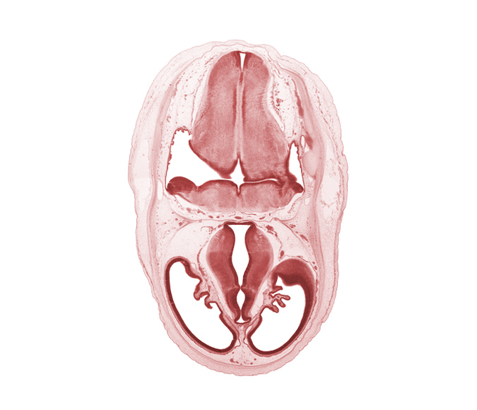 basilar artery, cerebral vesicle (telencephalon), diencephalon, dorsal thalamus, endolymphatic sac, lateral ventricle, marginal ridge, metencephalon (pons), myelencephalon (medulla oblongata), obex, posterior communicating artery, posterior dural venous plexus, rhombencoel (fourth ventricle), sulcus dorsalis, third ventricle, ventral thalamus, zona limitans intrathalamica