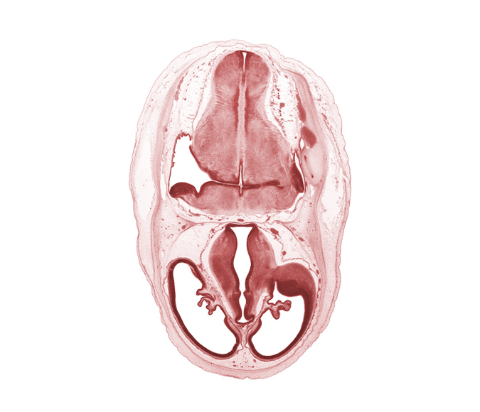 artifact separation(s), basilar artery, dorsal thalamus, endolymphatic sac, hypothalamic sulcus, hypothalamus, junction of central canal and obex, lateral recess of rhombencoel (fourth ventricle), marginal ridge, pons region (metencephalon), sensory decussation, sulcus dorsalis, third ventricle, venous plexus(es), ventral thalamus