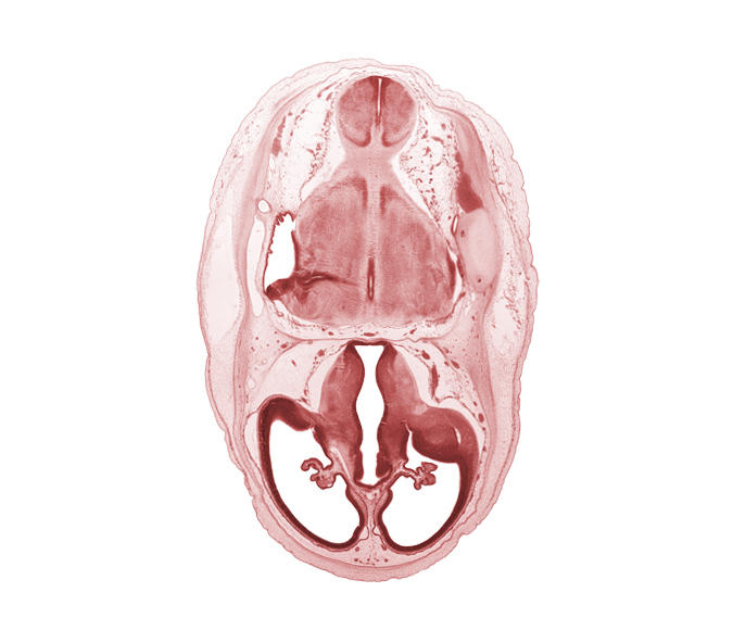 basilar artery, choroid fissure, choroid plexus, dural band for tentorium cerebelli, edge of rhombencoel (fourth ventricle), endolymphatic sac, intermediate zone, lateral ventricle, lateral ventricular eminence (telencephalon), marginal zone, myelencephalon (medulla oblongata), posterior communicating artery, pyramidal tract region, rhombencoel (fourth ventricle), roof of diencephalon, root of trigeminal nerve (CN V), stem of posterior dural venous plexus, third ventricle, ventricular zone