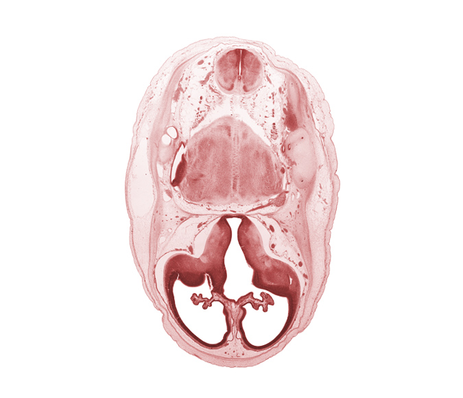 artifact separation(s), endolymphatic duct, internal carotid artery, lateral ventricle, lateral ventricular eminence (telencephalon), medial accessory olivary nucleus, medial ventricular eminence (diencephalon), myelencephalon (medulla oblongata), posterior communicating artery, pyramidal tract region, root of accessory nerve (CN XI), root of trigeminal nerve (CN V), third ventricle