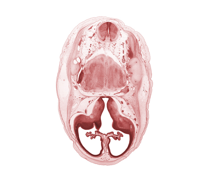 artifact separation(s), edge of lateral recess of rhombencoel (fourth ventricle), falx cerebri region, hypothalamic sulcus, internal carotid artery, interventricular foramen, lateral recess of rhombencoel (fourth ventricle), lateral ventricular eminence (telencephalon), medial ventricular eminence (diencephalon), myelencephalon (medulla oblongata), pons region (metencephalon), pyramidal tract region, root of accessory nerve (CN XI), root of glossopharyngeal nerve (CN IX), sigmoid sinus, vagus nerve (CN X)