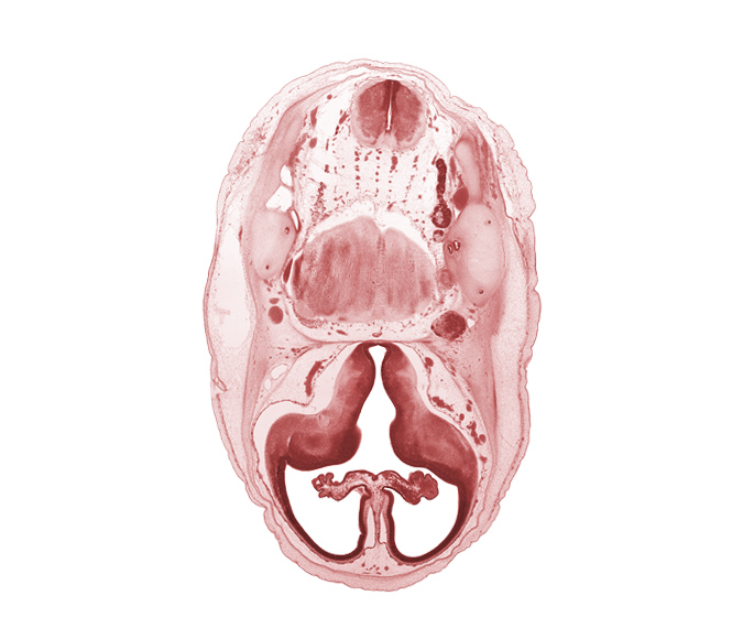 anterior semicircular duct, artifact separation(s), basilar artery, choroid plexus, edge of lateral recess of rhombencoel (fourth ventricle), fasciculus cuneatus, fasciculus gracilis, hypothalamic sulcus, hypothalamus, internal carotid artery, internal jugular vein, junction of internal carotid and posterior communicating arteries, lateral ventricular eminence (telencephalon), medial ventricular eminence (diencephalon), motor root of trigeminal nerve (CN V), otic capsule cartilage, pyramidal tract region, root of hypoglossal nerve (CN XII), trigeminal ganglion (CN V)