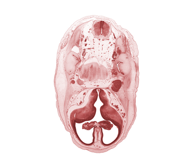 accessory nerve (CN XI), artifact separation(s), choroid plexus, facial nerve (CN VII), glossopharyngeal nerve (CN IX), hypothalamic sulcus, internal carotid artery, interventricular foramen, lateral ventricle, lateral ventricular eminence (telencephalon), medial ventricular eminence (diencephalon), myelencephalon (medulla oblongata), pons region (metencephalon), superior ganglion of vagus nerve (CN X), vestibulocochlear nerve (CN VIII)