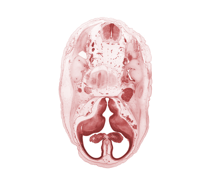 accessory nerve (CN XI), anterior semicircular duct, artifact separation(s), basilar artery, choroid fissure, choroid plexus, facial nerve (CN VII), glossopharyngeal nerve (CN IX), hypothalamic sulcus, internal carotid artery, lateral ventricular eminence (telencephalon), medial ventricular eminence (diencephalon), myelencephalon (medulla oblongata), pons region (metencephalon), posterior semicircular duct, root of abducens nerve (CN VI), root of hypoglossal nerve (CN XII), trigeminal ganglion (CN V), vagus nerve (CN X), vestibulocochlear ganglion (CN VIII)