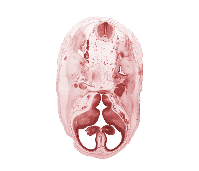 abducens nerve (CN VI), accessory nerve (CN XI), artifact separation(s), basilar artery, cerebral vesicle (telencephalon), glossopharyngeal nerve (CN IX), hypothalamic sulcus, hypothalamus, internal carotid artery, internal jugular vein, lateral ventricle, medial ventricular eminence (diencephalon), motor root of trigeminal nerve (CN V), myelencephalon (medulla oblongata), pons region (metencephalon), subarachnoid space, third ventricle, vagus nerve (CN X)