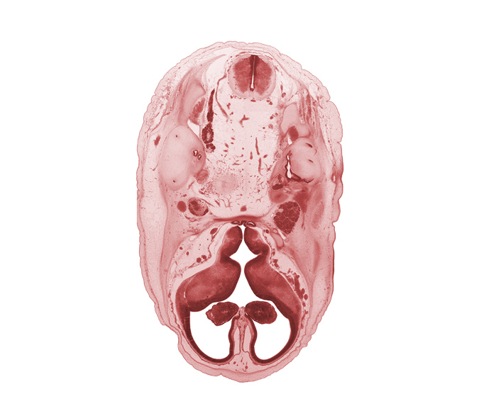 basilar artery, central canal, corpus striatum, edge of pons region (metencephalon), facial nerve (CN VII), glossopharyngeal nerve (CN IX), hippocampus, hypothalamus, intermediate zone, internal carotid artery, internal jugular vein, interventricular foramen, junction of brain and spinal cord, marginal zone, medial ventricular eminence (diencephalon), neurohypophysis, optic groove, otic capsule cartilage, root of hypoglossal nerve (CN XII), semicircular duct, trigeminal ganglion (CN V), tuberal part of adenohypophysis, vagus nerve (CN X), ventricular zone