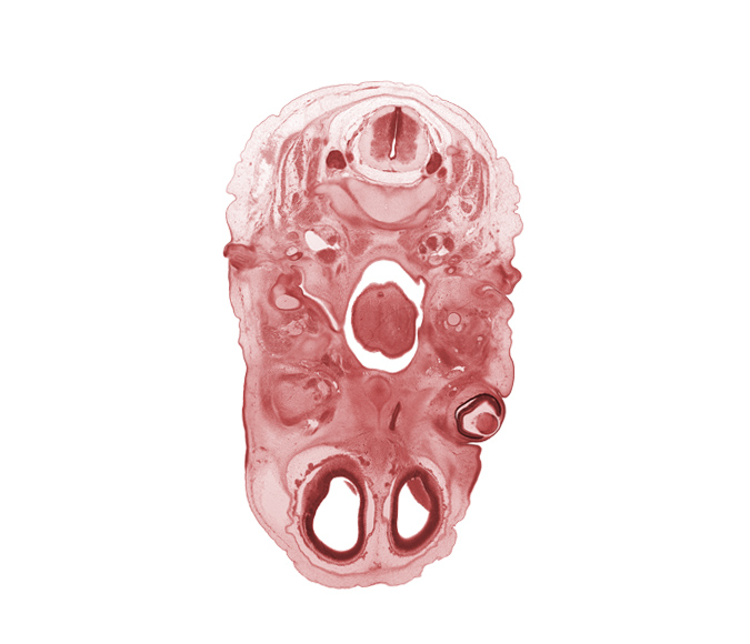 C-2 spinal ganglion, C-3 spinal ganglion, artifact separation(s), atlanto-axial joint, blastema of extra-ocular muscle(s), centrum of C-2 vertebra (axis), cornea, dorsum of tongue, edge of nasal ectoderm, glossopharyngeal nerve (CN IX), inferior ganglion of vagus nerve (CN X), internal jugular vein, lateral ventricle, lens, lower eyelid, nasopharynx, olfactory filia (CN I), oral cavity, oropharynx, pharyngeal arch 1 cartilage (Meckel), subarachnoid space, thyroglossal duct, upper eyelid