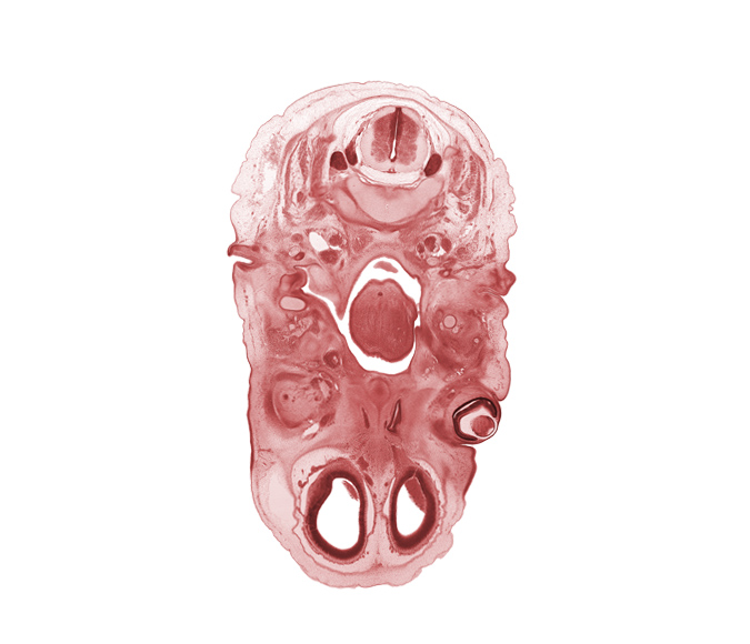 C-3 dorsal root, C-3 spinal ganglion, anterior cerebral artery, artifact separation(s), blastema of medial rectus muscle, blastemata of tongue muscles, cerebral vesicle (telencephalon), edge of epiglottis, edge of nasal cavity (nasal sac), edge of palatine shelf, glossopharyngeal nerve (CN IX), inferior ganglion of vagus nerve (CN X), internal jugular vein, lateral ventricle, nasopharynx, osteogenic layer, pharyngotympanic tube, superior cervical sympathetic ganglion, supra-orbital vein, thyroglossal duct, vertebral artery