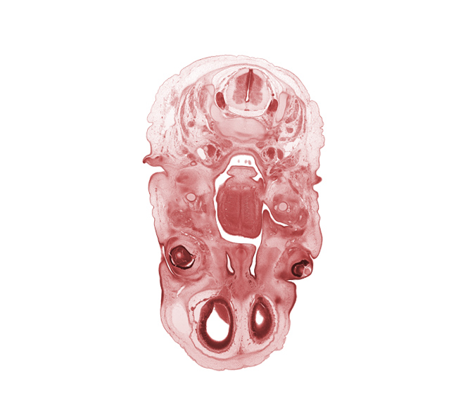 C-3 spinal ganglion, C-3 spinal nerve, auricle, dorsal root(s), edge of lateral ventricle, edge of lens, edge of optic cup cavity, epiglottis, frontal prominence, glossopharyngeal nerve (CN IX), hypoglossal nerve (CN XII), inferior ganglion of vagus nerve (CN X), nasal cavity (nasal sac), olfactory bulb, olfactory filia (CN I), palatine shelf, pharyngeal arch 1 cartilage (Meckel), retropharyngeal space, superior cervical sympathetic ganglion