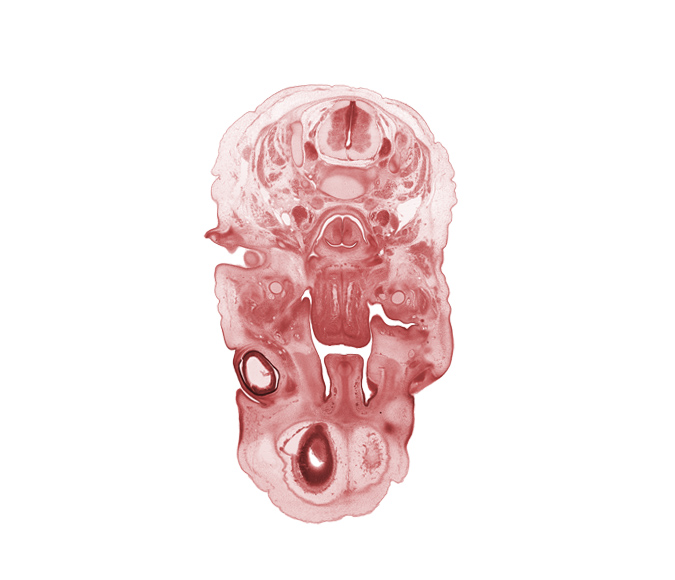 C-3 / C-4 intervertebral disc, C-4 spinal ganglion, auricle, blastema of extra-ocular muscle(s), edge of cerebral vesicle(s), edge of lateral ventricle, external acoustic meatus, frontal prominence, hypoglossal nerve (CN XII), inferior alveolar nerve, inferior ganglion of vagus nerve (CN X), infra-orbital nerve, intraretinal space (optic vesicle cavity), larynx, lingual nerve, nasal septum, optic cup cavity, semispinalis capitis muscle, semispinalis cervicis muscle, spinal accessory nerve (CN XI), splenius muscle, superior cervical sympathetic ganglion, trapezius muscle, vertebral artery