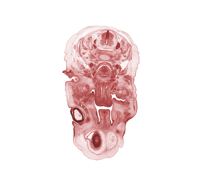 C-3 / C-4 intervertebral disc, C-4 spinal ganglion, C-4 spinal nerve, cerebral vesicle (telencephalon), choana, crista galli, ethmoid condensation, external acoustic meatus, falx cerebri region, infra-orbital region, internal carotid artery, lower eyelid, nasal cavity (nasal sac), neural layer of retina, oral cavity, palatine shelf, pigmented layer of retina, spinal accessory nerve (CN XI), splenius muscle, sternocleidomastoid muscle, subarachnoid space, trapezius muscle, upper eyelid