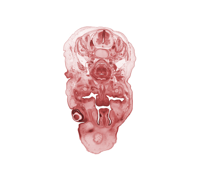 C-4 spinal ganglion, C-5 spinal ganglion, arytenoid condensation, body of hyoid (pharyngeal arch 3 cartilage), choana, edge of subarachnoid space, hypoglossal nerve (CN XII), inferior pharyngeal constrictor muscle, laryngeal inlet, laryngeal pharynx, longus cervicis muscle, nasal cavity (nasal sac), oral cavity, palatine shelf, retropharyngeal space, sympathetic trunk, vomeronasal organ