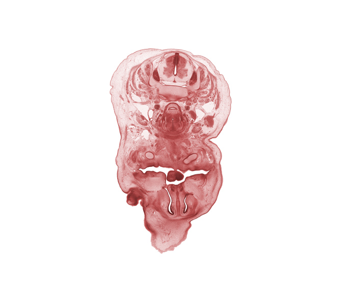 C-5 spinal ganglion, anterior spinal artery, caudal edge of eyeball, external jugular vein, frenulum of tongue, internal carotid artery, interorbital ligament, jugular lymph sac, laryngeal condensation, longus cervicis muscle, nasal capsule, nasal cavity (nasal sac), nasal septal cartilage, oral cavity, pharyngeal arch 1 cartilage (Meckel), platysma muscle, semispinalis capitis muscle, semispinalis cervicis muscle, splenius muscle, sternocleidomastoid muscle, subarachnoid space, superior parathyroid gland, trapezius muscle