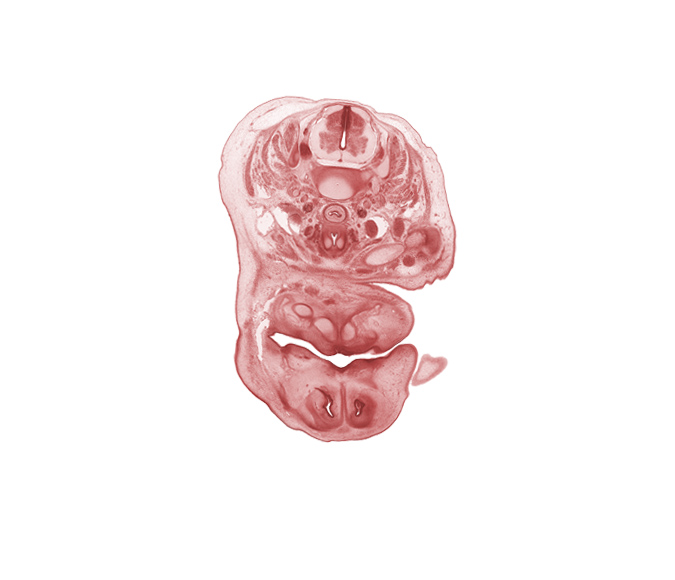 C-5 / C-6 intervertebral disc, C-6 spinal ganglion, C-6 spinal nerve, anterior spinal artery, central canal, clavicle, edge of upper limb, inferior parathyroid gland, internal carotid artery, interorbital ligament, jugular lymph sac, laryngeal cartilage, median mandibular groove, nasal capsule, oral cavity, platysma muscle, primary palate, thyroid gland, vertebral artery