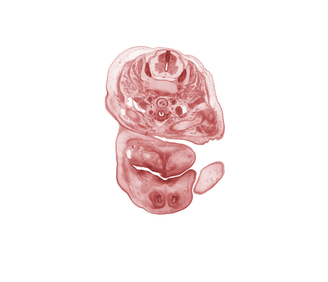 C-6 spinal ganglion, blastema of facial muscle, central canal, dorsal horn of grey matter, epithelial plug in naris, inferior ganglion of vagus nerve (CN X), inferior parathyroid gland, internal carotid artery, internal jugular vein, jugular lymph sac, nose, oral fissure, platysma muscle, primary palate, scapula, subarachnoid space, sympathetic trunk, thyroid gland, trachea, upper limb, ventral horn of grey matter