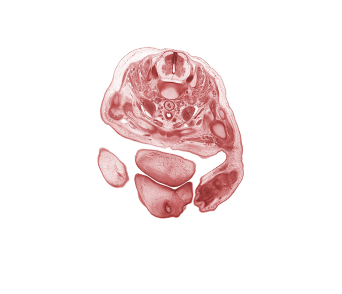 C-5 / C-6 intervertebral disc, C-6 spinal ganglion, C-6 spinal nerve, blastemata of extensor muscles in forearm, central canal, chin, clavicle, dorsal funiculus, dorsum of hand, edge of left naris, epithelial plug in right naris, humerus, internal jugular vein, lateral funiculus, left lobe of thymus gland, oral fissure, right lobe of thymus gland, trachea, upper limb, vagus nerve (CN X), ventral funiculus