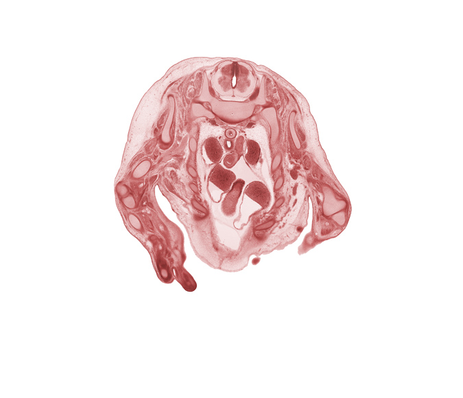 T-1 spinal ganglion, aorta, ascending aorta, caudal edge of left digit 2 (index finger), caudal segment of left precardinal vein, cephalic edge of right ventricle, digit 5 (little finger), ductus arteriosus, elbow joint, esophagus, head of rib 1, left atrium, mammary gland, neural arch, phrenic nerve, radius, rib 3, right atrium, right vagus nerve (CN X), superior vena cava, trachea, ulna