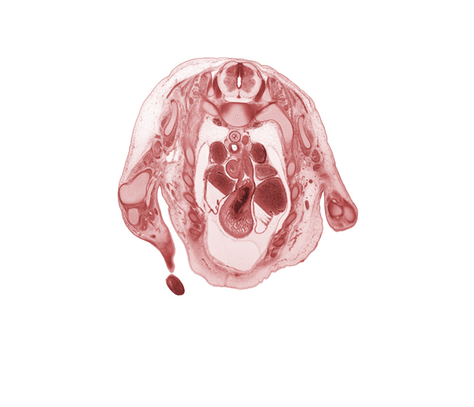 T-1 spinal ganglion, aorta, ascending aorta, blood cells in left atrium, cardiac prominence, esophagus, head of rib 2, intermediate zone, marginal zone, musculi pectinati in wall of left auricle, musculi pectinati in wall of right auricle, pericardial cavity, phrenic nerve, pulmonary semilunar valve, pulmonary trunk, superior vena cava, sympathetic ganglion, trachea, ulna, ulnar nerve, ventricular zone