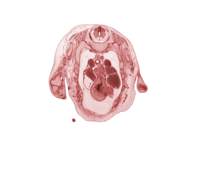 T-1 / T-2 interganglion region, T-1 dorsal root, anterior interventricular sulcus, ascending aorta, atrioventricular sulcus, caudal edge of hand, left atrium, musculi pectinati in wall of right auricle, notochord, pericardial cavity, phrenic nerve, pulmonary trunk bifurcation, rhomboid major muscle, rib 2, rib 3, superior vena cava, trapezius muscle