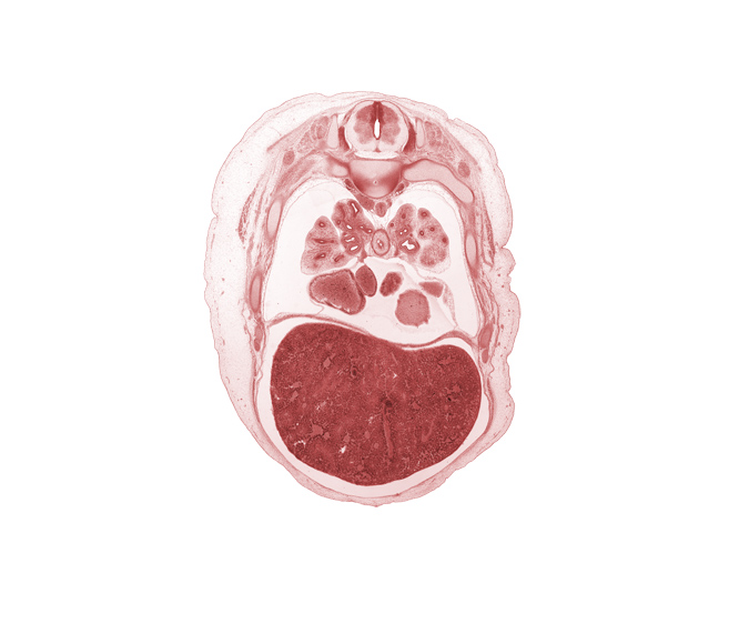 T-5 spinal ganglion, anterior basal segmental bronchus, caudal edge of left atrium, inferior vena cava, lateral basal segmental bronchus, left lobe of liver, left ventricle, lower lobe of left lung, lower lobe of right lung, medial basal segmental bronchus, middle lobe of right lung, oblique fissure, posterior basal segmental bronchus, rib 6, rib 7, right atrium, right lobe of liver, upper lobe of left lung