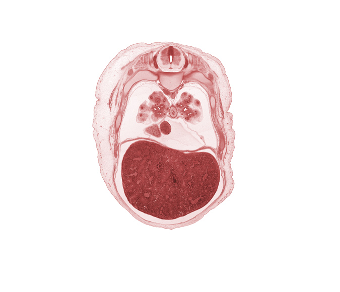 T-6 spinal ganglion, T-6 spinal nerve, azygos vein, caudal edge of middle lobe of right lung, central canal, central tendon of diaphragm, efferent hepatic vein, inferior vena cava, lateral basal segmental bronchus, left lobe of liver, lower lobe of right lung, oblique fissure, pericardial cavity, posterior basal segmental bronchus, rib 7, rib 8, right lobe of liver