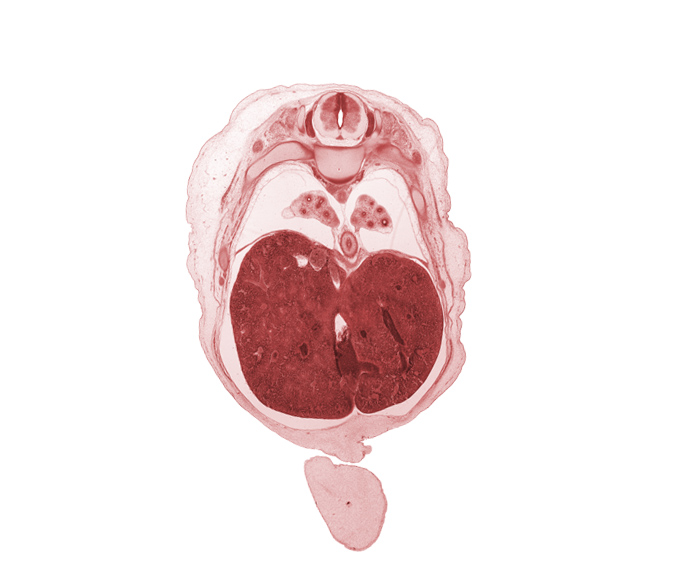 T-8 spinal ganglion, T-8 spinal nerve, afferent hepatic vein, anterior gastric nerve (CN X), diaphragm, ductus venosus, iliocostalis muscle, inferior vena cava (hepatic part), junction of ductus venosus and inferior vena cava, latissimus dorsi muscle, left lobe of liver, longissimus muscle, lower lobe of left lung, lower lobe of right lung, muscular layer of esophagus, pleural recess, posterior gastric nerve (CN X), rib 9, right lobe of liver, spinalis muscle, umbilical cord