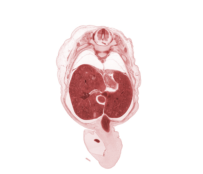 T-10 spinal ganglion, T-9 spinal nerve, afferent hepatic vein, caudate lobe of liver, cephalic edge of gall bladder, edge of herniated midgut, grey matter, hepatic portal vein, inferior vena cava (hepatic part), junction of esophagus and stomach, left lobe of liver, lesser sac (omental bursa), notochord, pleural recess, rib 10, right lobe of liver, umbilical cord, umbilical vein, wall of pyloric antrum of stomach, white matter