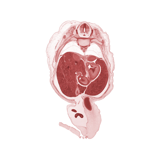 T-10 spinal ganglion, T-10 spinal nerve, aorta, central canal, centrum of T-10 vertebra, common hepatic duct, cystic duct, distal limb of herniated midgut, endoderm lining, endoderm lining of stomach (mucosa), gall bladder, head of rib 10, hepatic artery, hepatic portal vein, intermediate zone, lesser curvature of stomach, marginal zone, muscularis of pyloric antrum of stomach, peritoneal cavity, pleural cavity, proximal limb of herniated midgut, splanchnic mesoderm, superior part of duodenum (first part), suprarenal gland cortex, umbilical coelom, umbilical vein, ventricular zone